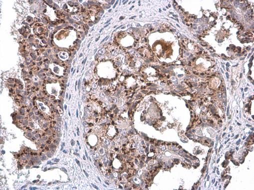 GOLPH2 antibody [C3], C-term