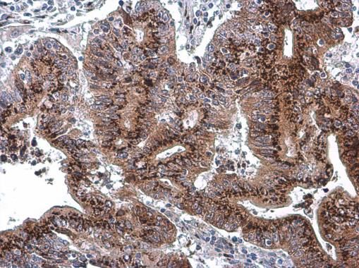 GOLPH2 antibody [C3], C-term
