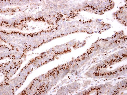 GOLPH2 antibody [C3], C-term
