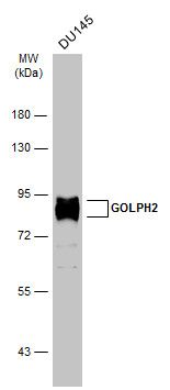 GP73 antibody