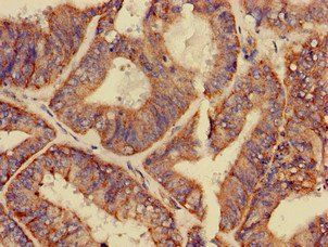GPAM Antibody