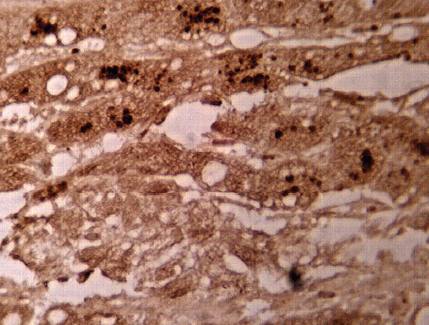Sheep Human Glypican-3 (GPC3) Antibody