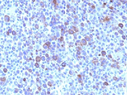 Glypican-3 (GPC3) (Hepatocellular Carcinoma Marker) Antibody