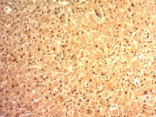 Glypican-3 (GPC3) (Hepatocellular Carcinoma Marker) Antibody