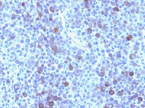 Glypican-3 (GPC3) (Hepatocellular Carcinoma Marker) Antibody