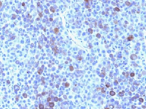 GPC3 antibody