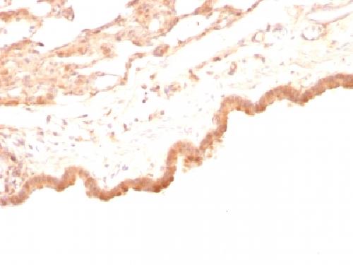 Glypican-3 (GPC3) (Hepatocellular Carcinoma Marker) Antibody