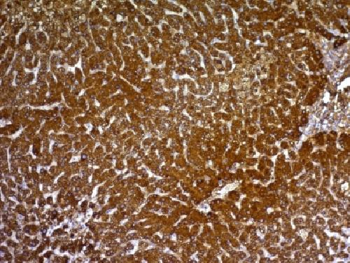 Glypican-3 (GPC3) (Hepatocellular Carcinoma Marker) Antibody