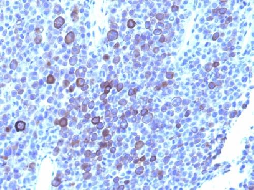 Glypican-3 (GPC3) (Hepatocellular Carcinoma Marker) Antibody