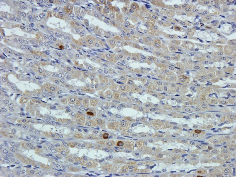 GPC3 antibody