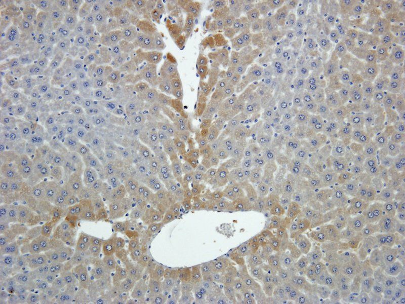 GPC3 antibody