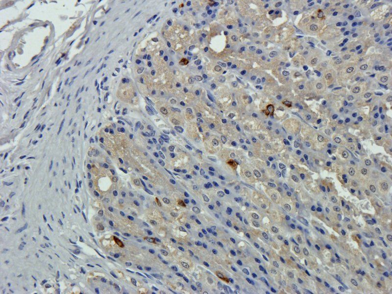 GPC3 antibody