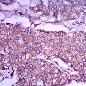 GPC3 Antibody