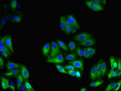 GPC4 Antibody