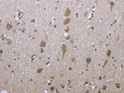 GPC6 Antibody