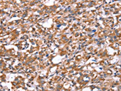 GPC6 Antibody