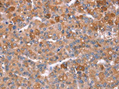 GPC6 Antibody