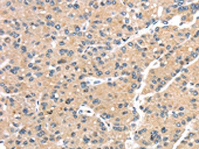 GPD2 antibody