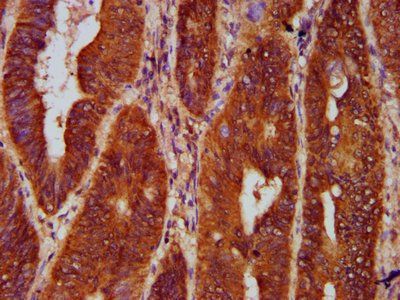 GPHN Antibody