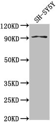 GPLD1 Antibody