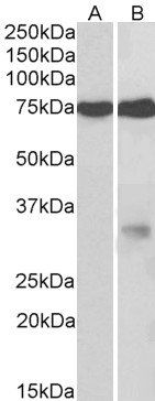 Goat anti-GPM6A Antibody