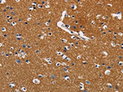 GPM6A Antibody