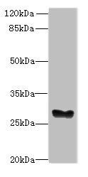 GPM6B antibody
