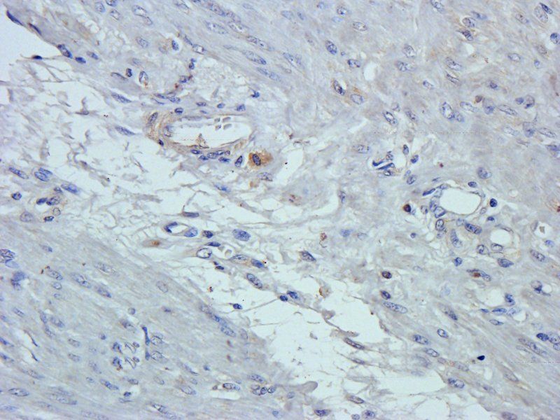 GPR109A antibody