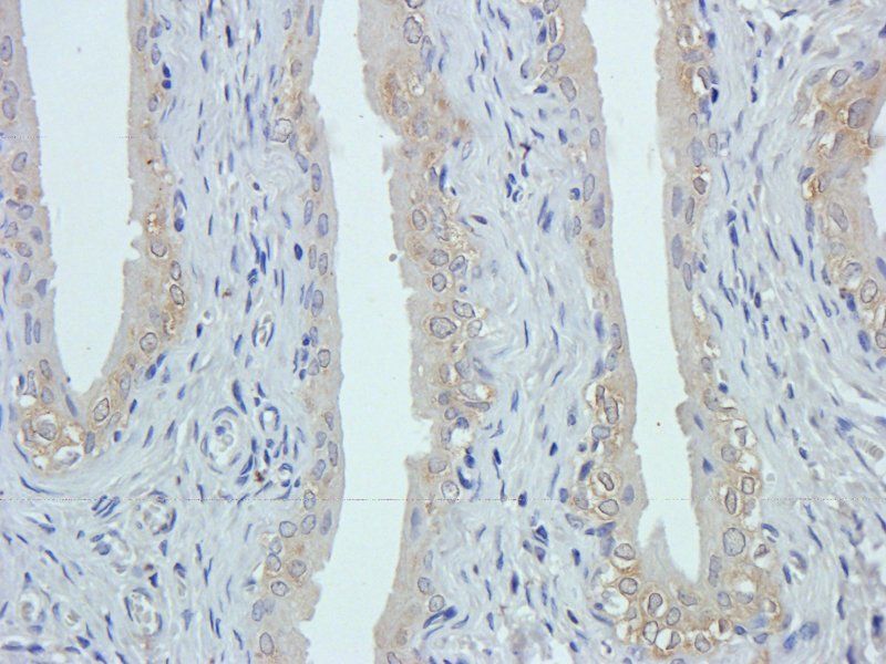 GPR109A antibody