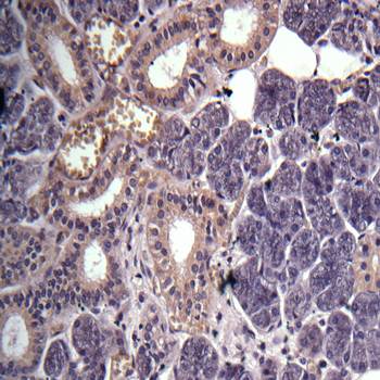 GPR114 Rabbit Polyclonal Antibody