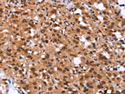 GPR124 Antibody