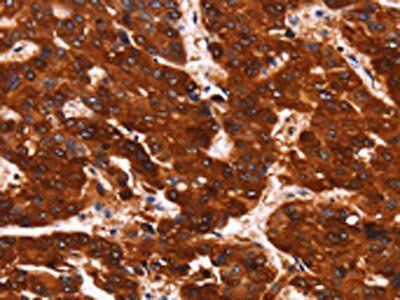 GPR124 Antibody