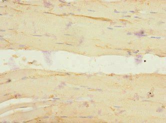 ADGRG6 Antibody