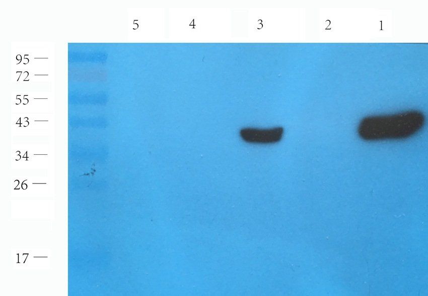 GPR133 antibody