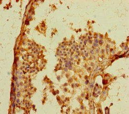 GPR156 Antibody