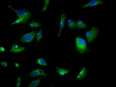 GPR158 Antibody