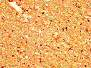 GPR158 Antibody