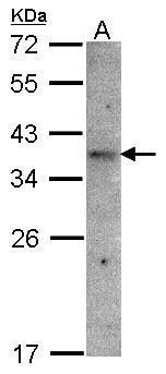 GPR164 antibody [N2C1], Internal