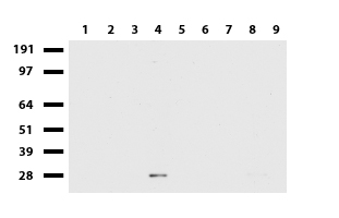 GPR17 Antibody