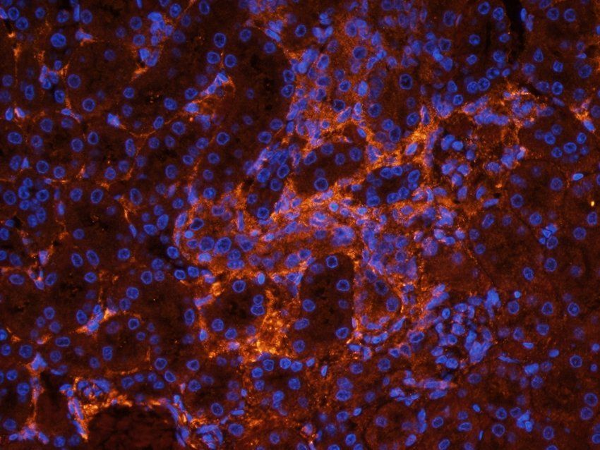 GPR17 antibody