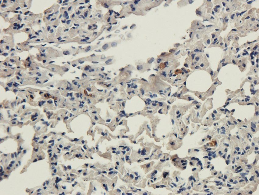 GPR17 antibody