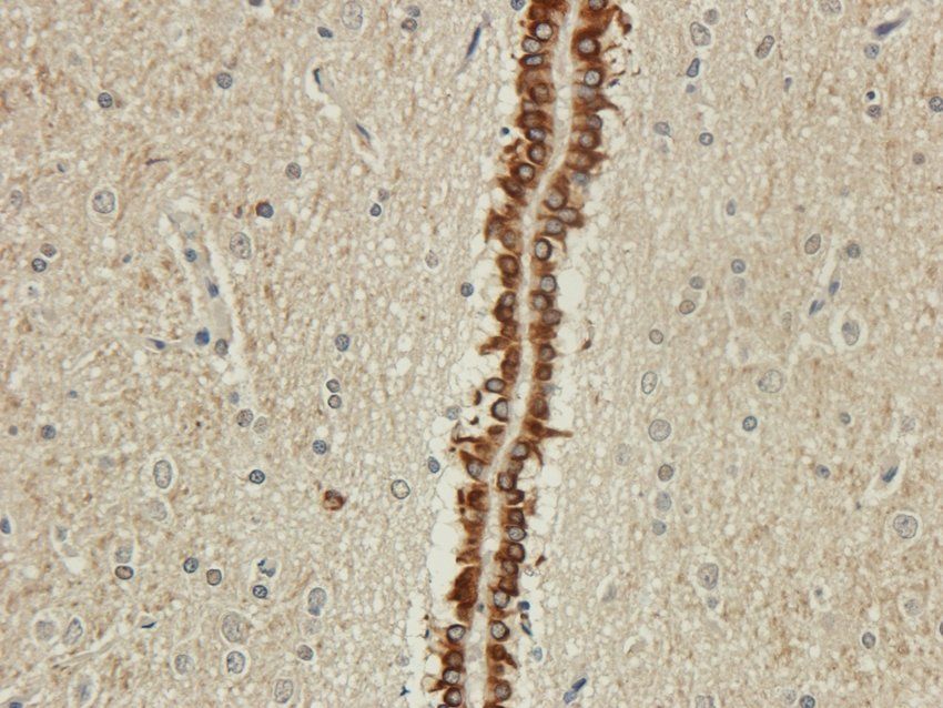 GPR17 antibody