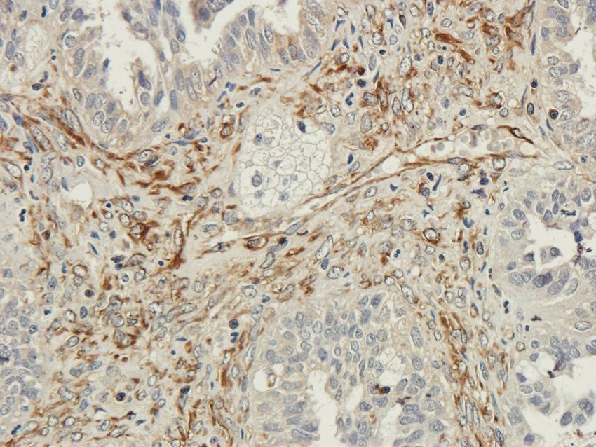 GPR17 antibody