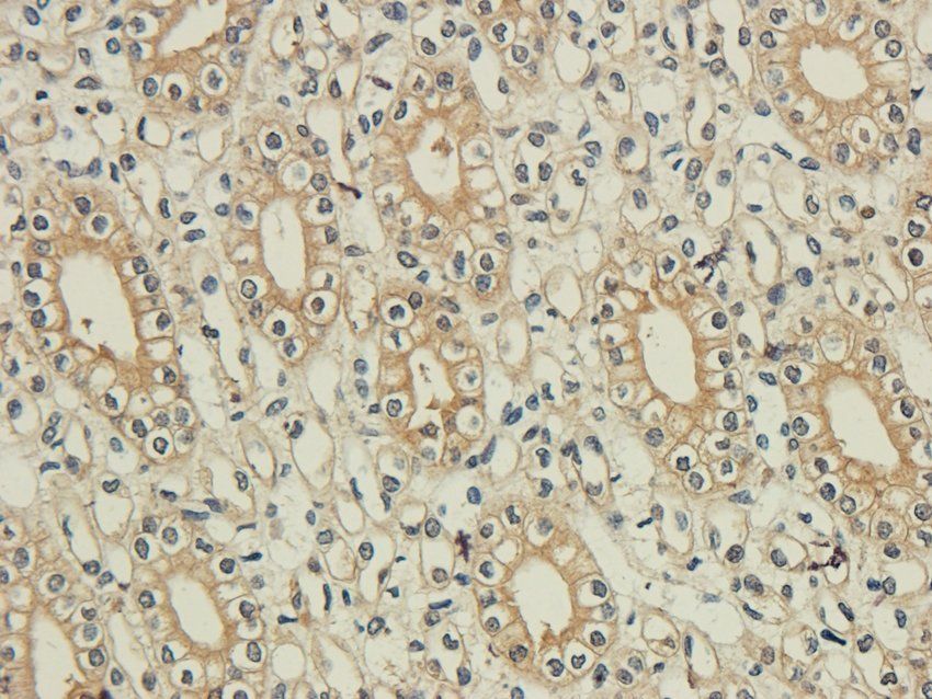 GPR17 antibody