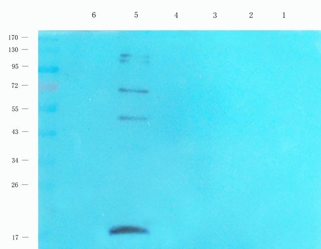 GPR17 antibody