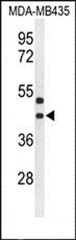 GPR17 antibody