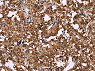 GPR171 Antibody