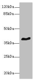 GPR18 antibody