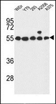 GPR180 antibody