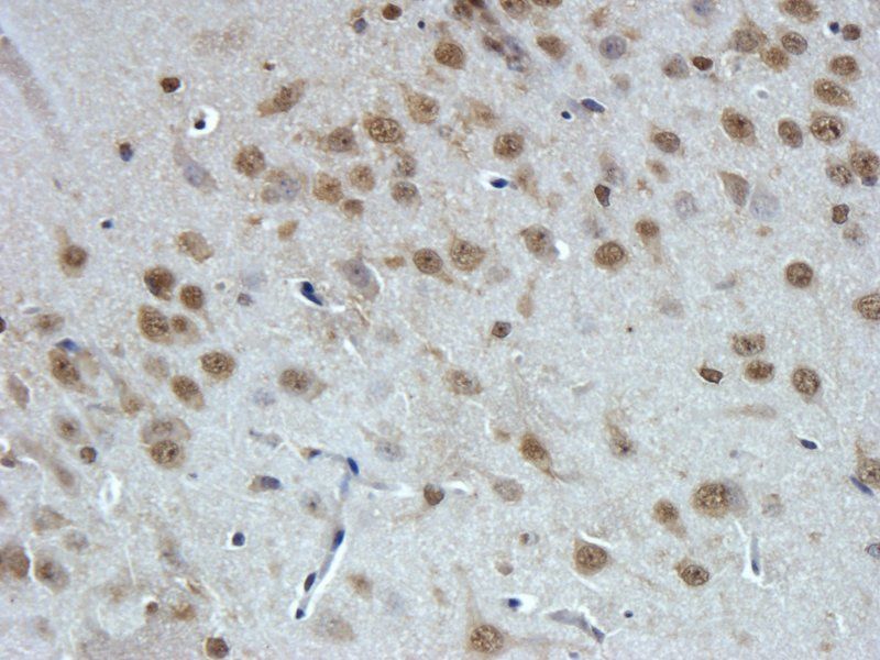 GPR1 antibody